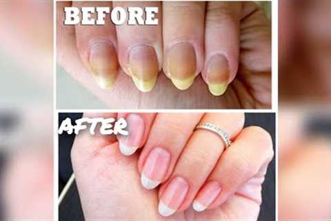 How To Keep Your Nails Clean And White | Nail Cleaning Tutorial | How to Clean Nails #nails