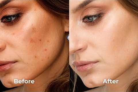 Jaw-Dropping Natural Skin Care Hacks: Get Glowing Skin in Just 7 Days