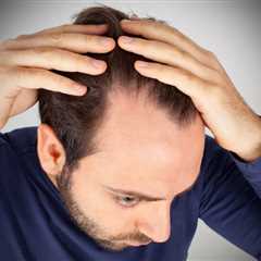 Simple Tricks To Prevent Excessive Hair Fall
