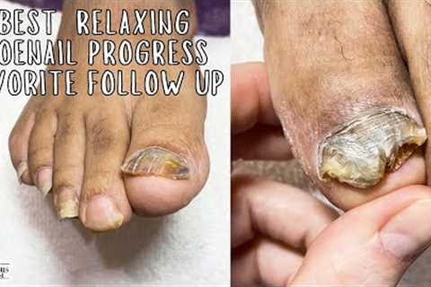 Best Toe nail Improvement and Relaxing Pedicure