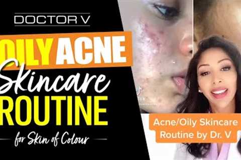 Doctor V - Oily, Acne Skincare Routine For Skin of Colour | Brown Or Black Skin | #shorts